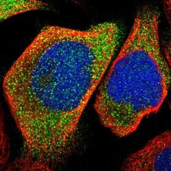 KLHDC1 Antibody, Novus Biologicals 0.1mL; Unlabeled:Antibodies, Polyclonal